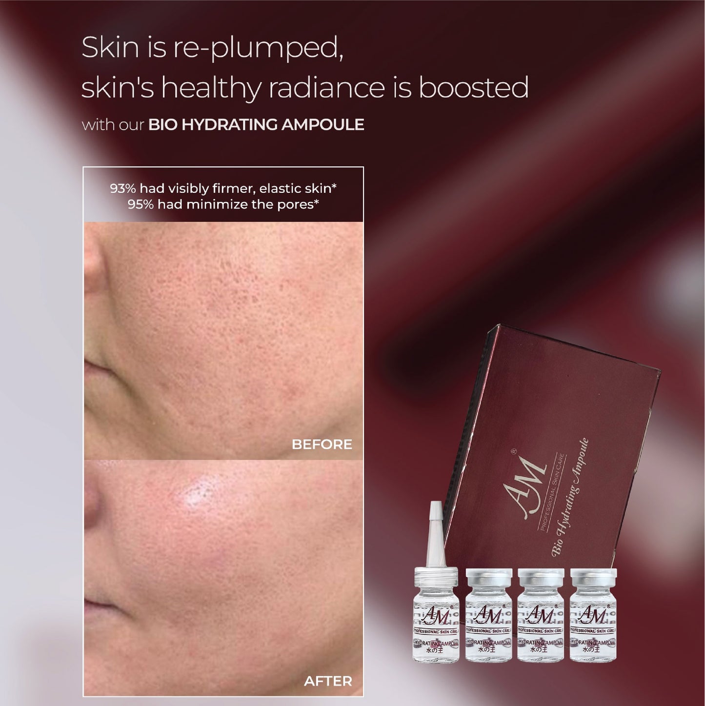 HOT SELLING - SUPER BABY SKIN SET