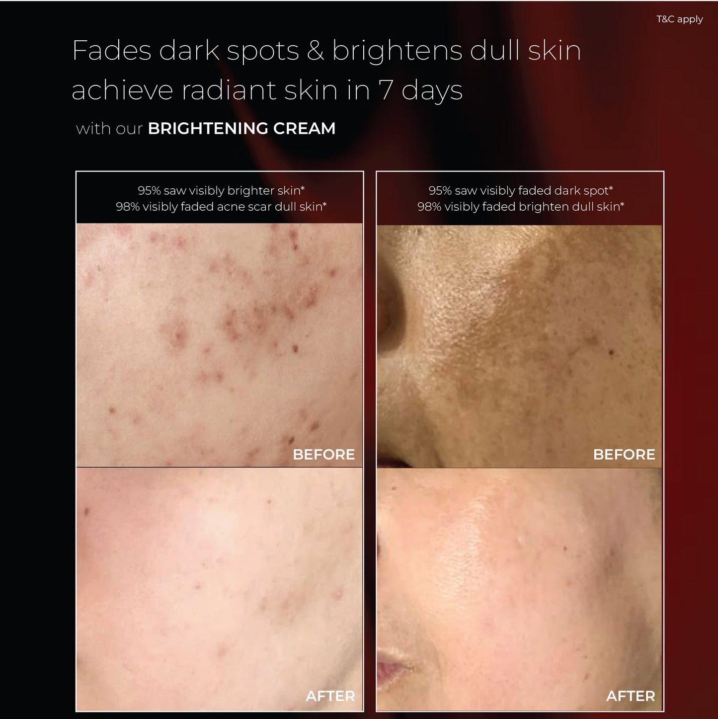 SkinPlus+ BRIGHTENING CREAM